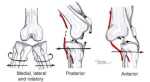 Knee-Dislocation