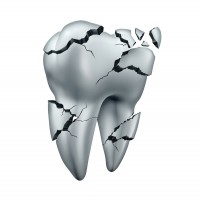 tooth-fracture-drawing-canstockphoto26445718-200x200